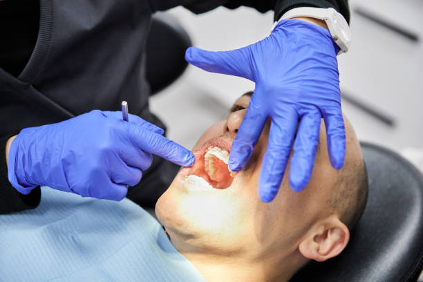 Best Emergency Broken Tooth Repair in Mountain House, CA