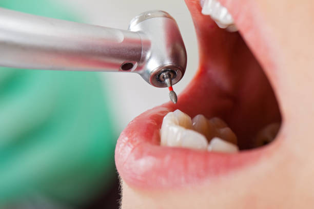 Best Walk-In Emergency Dentist in Mountain House, CA